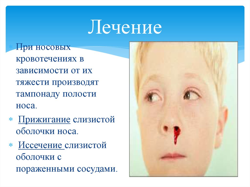 Болезнь Рандю-Ослера (наследственная телеангиоэктазия) - презентация онлайн