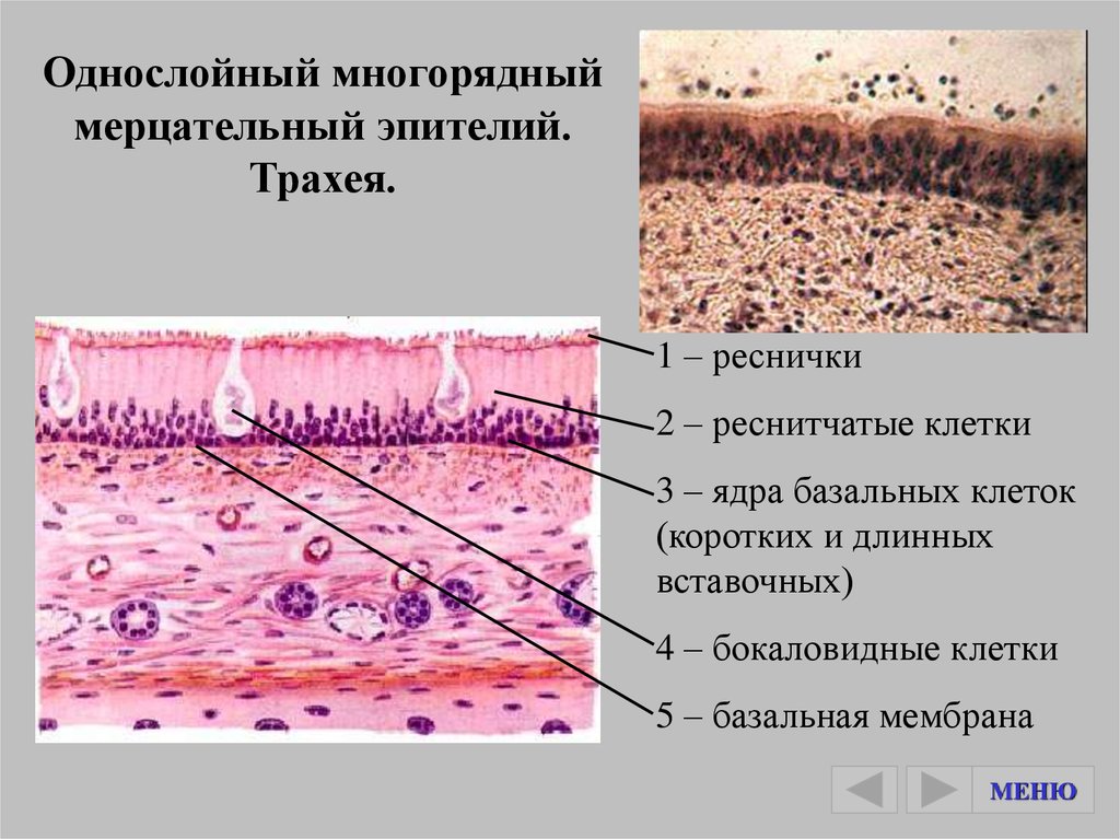 Трахею выстилает эпителий. Однослойный призматический реснитчатый мерцательный эпителий. Клетки реснитчатого эпителия. Мерцательный эпителий гистология. Многоядерный призматический эпителий.