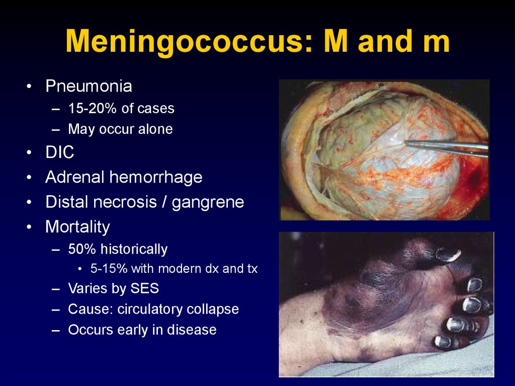 Meningococcus: M and m