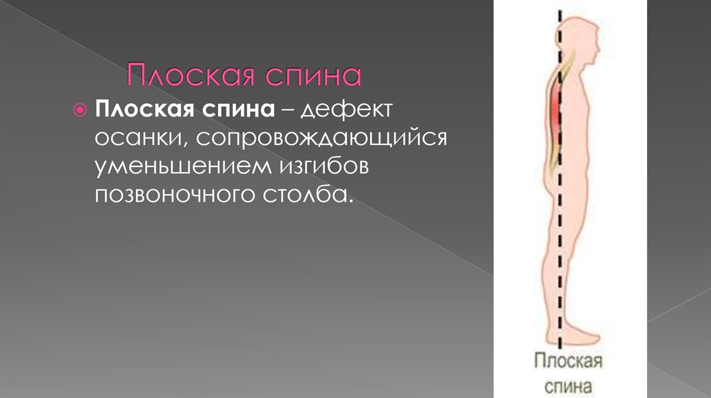 Плоская спина