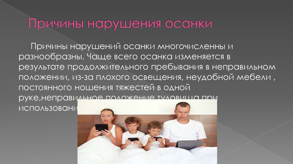 Причины нарушения осанки