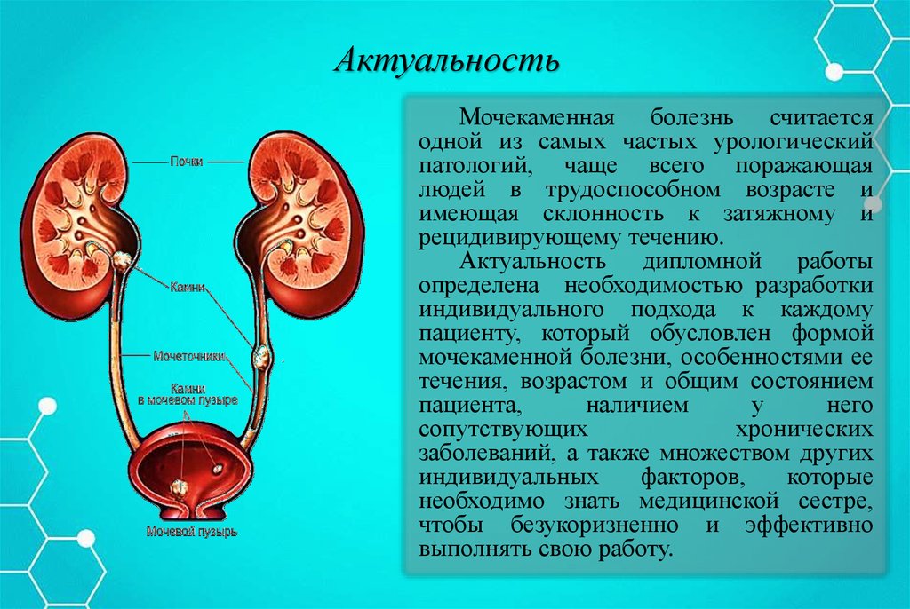 Мочекаменная болезнь осложнения