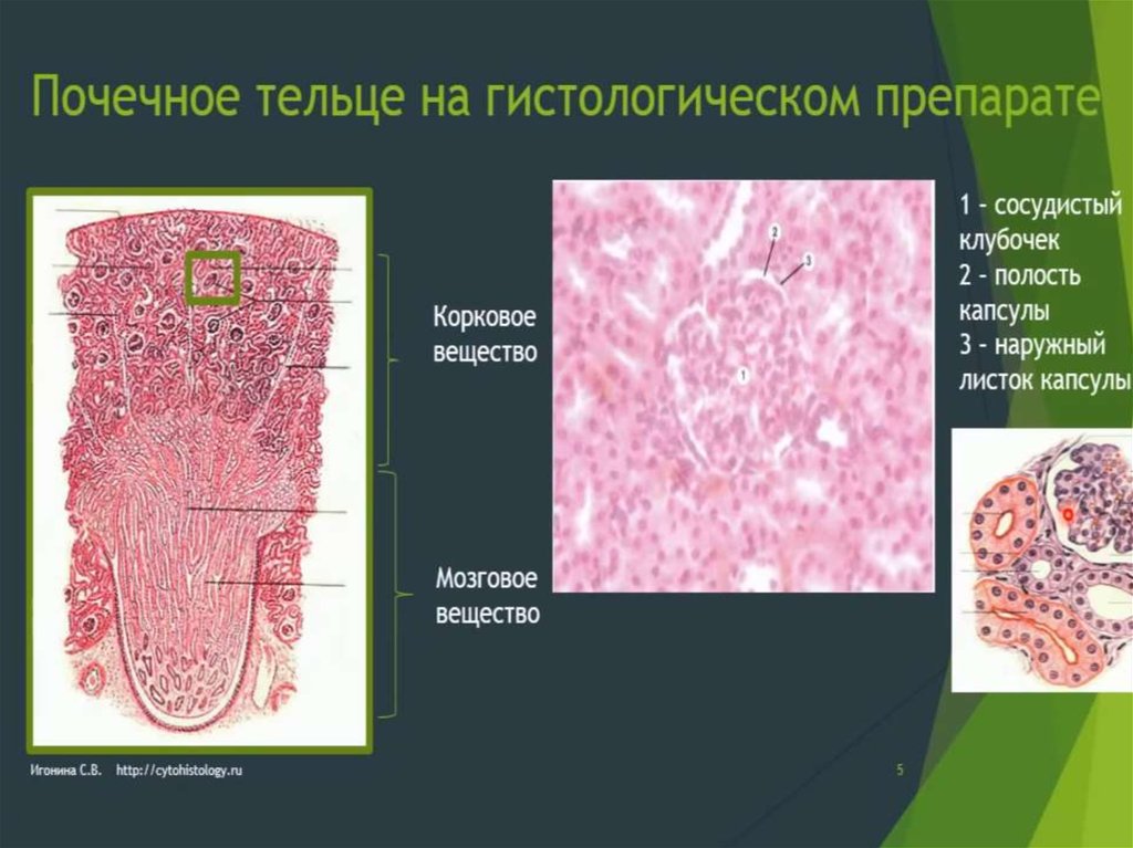 Почка гистология. Капсула почки гистология. Мозговое вещество почки гистология. Корковое вещество почки гистология.