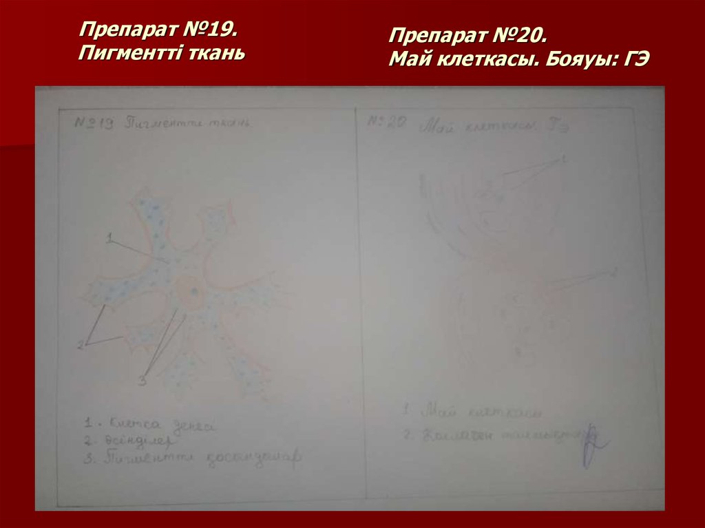 Препарат №19. Пигментті ткань