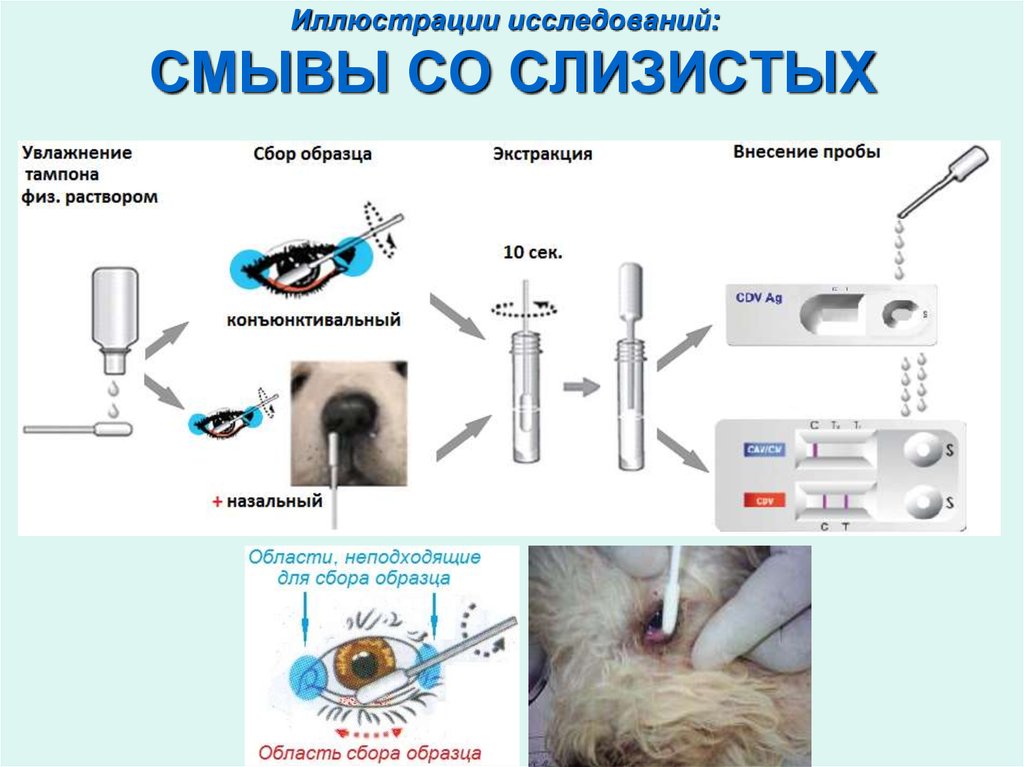 Иллюстрации исследований: СМЫВЫ СО СЛИЗИСТЫХ