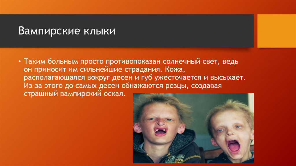 Синдром Гюнтера - презентация онлайн