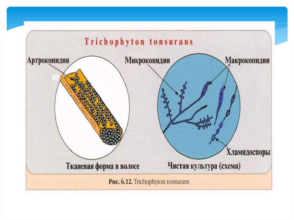 Патогенные микобактерии. Оппортунистические микозы микробиология. Артроконидии. Микроконидии и макроконидии.