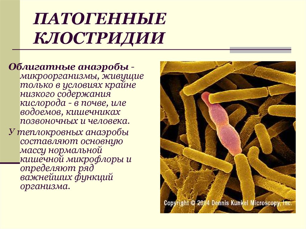 Микроорганизмы обитающие в почве относятся к группе. Патогенные клостридии перфрингенс. Клостридии – анаэробные микробы. Условно-патогенные микроорганизмы клостридия. Клостридии кишечной инфекции.