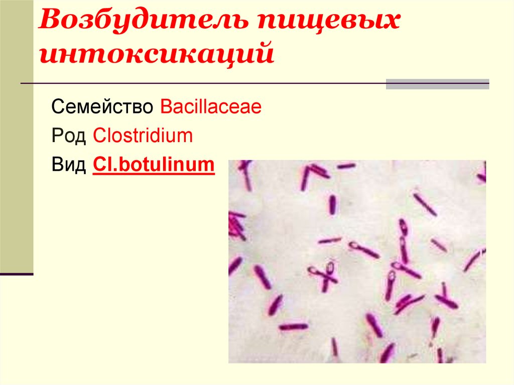 Clostridium botulinum презентация