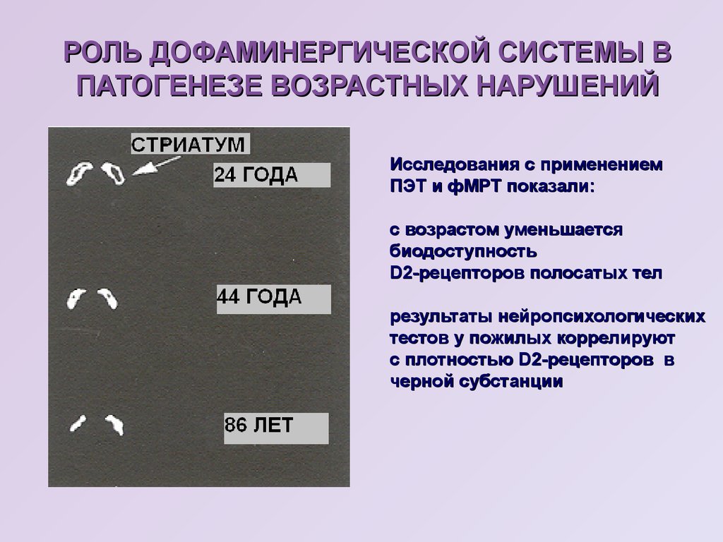 Дофаминергическая система презентация