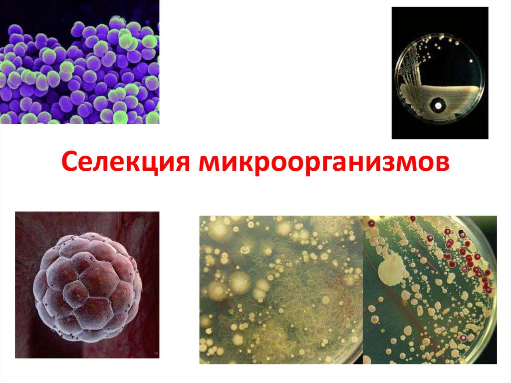 Методы селекции микроорганизмов презентация