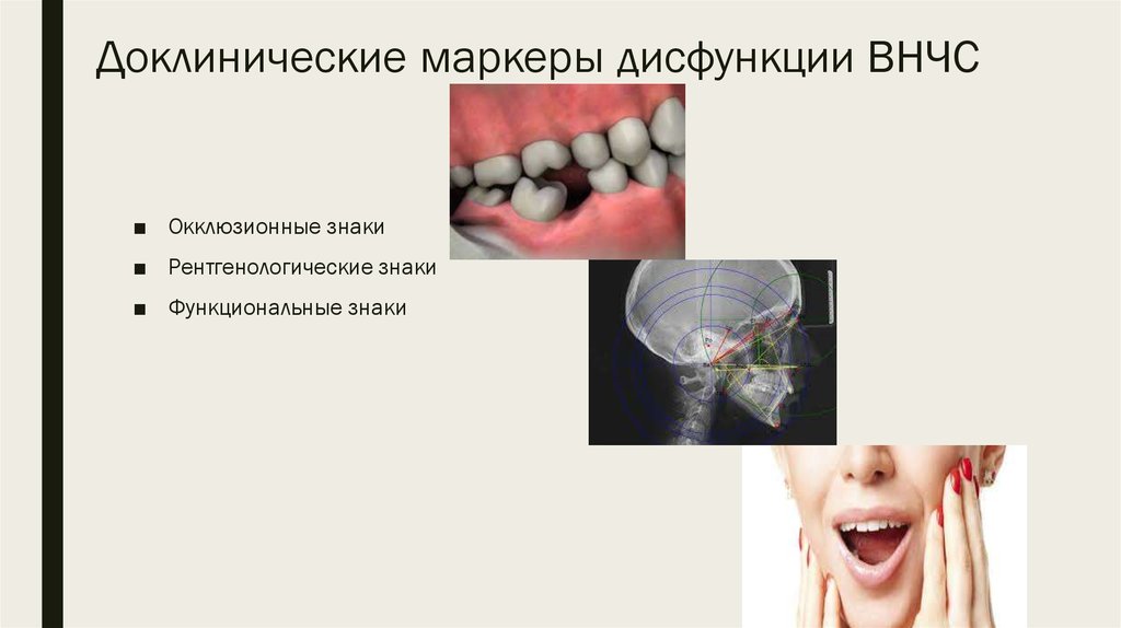 Ортодонтическое лечение детей презентация