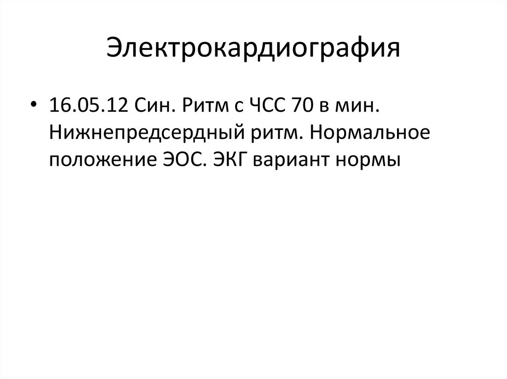 Электрокардиография