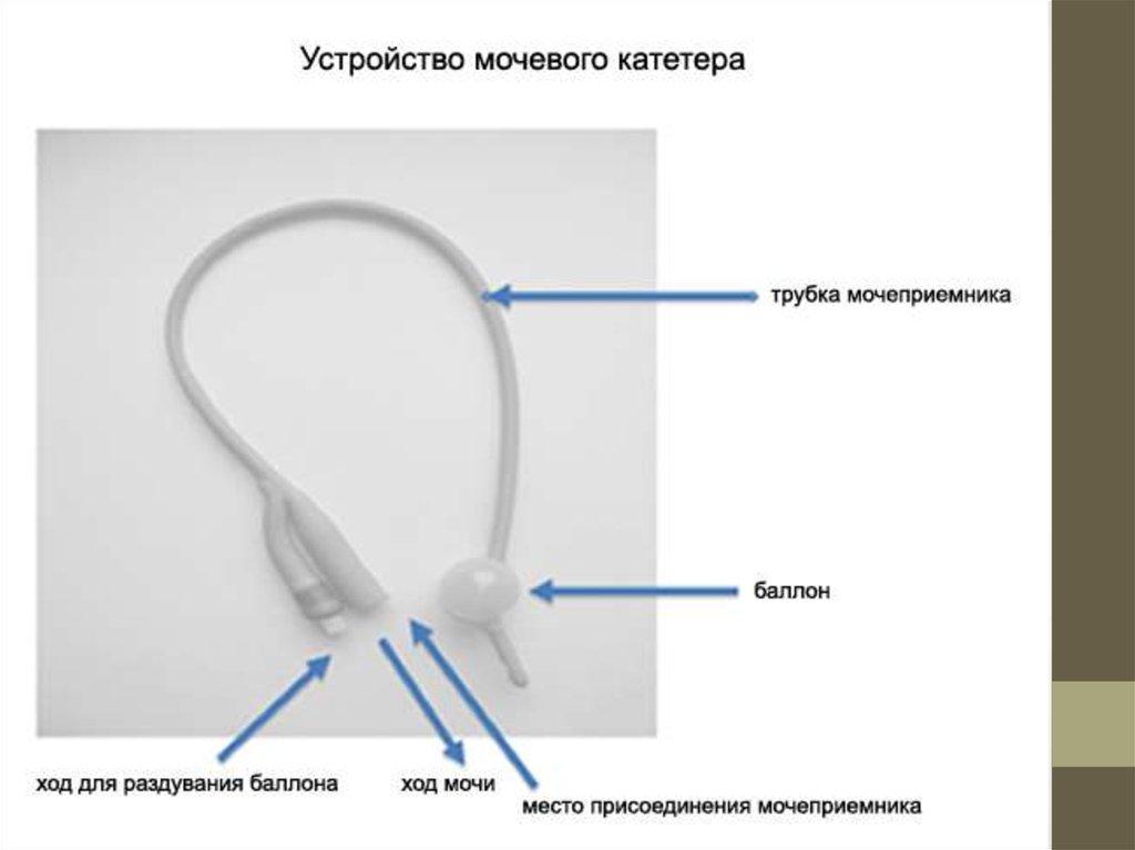 Замена катетера фолея карта вызова