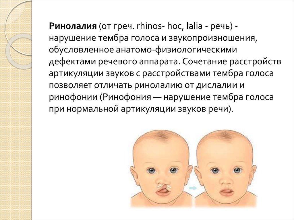 Ринолалия картинки для презентации