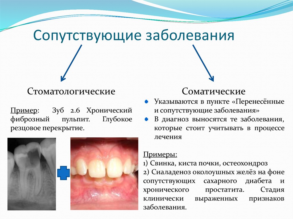 Перенесенные заболевания. Сопутствующие заболевания. Перенесенные и сопутствующие заболевания стоматология. Сопутствующее заболевание это. Сопутствующие заболевания в стоматологии.