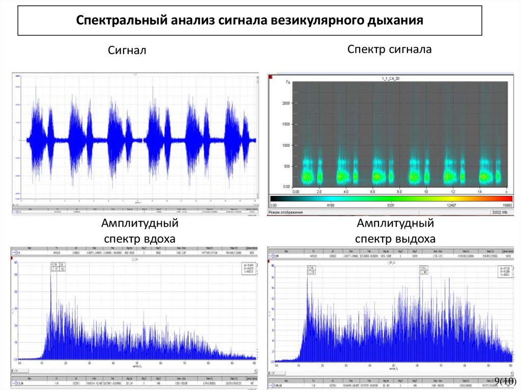 Спектральный 2022. Спектральная плоскость акустического сигнала. Линейный спектр акустического сигнала. Спектр Pal сигнала. Спектральный анализ биомедицинского сигнала.