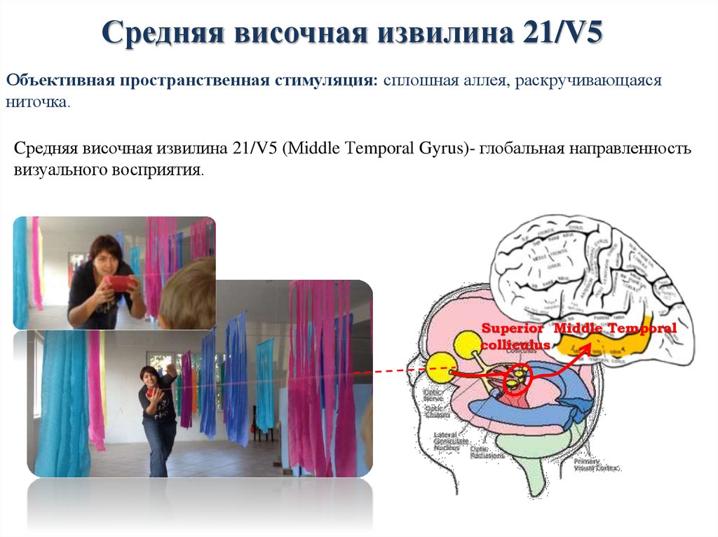 Средняя височная извилина 21/V5