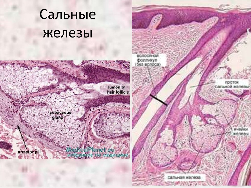 Сальные железы где находятся у человека фото