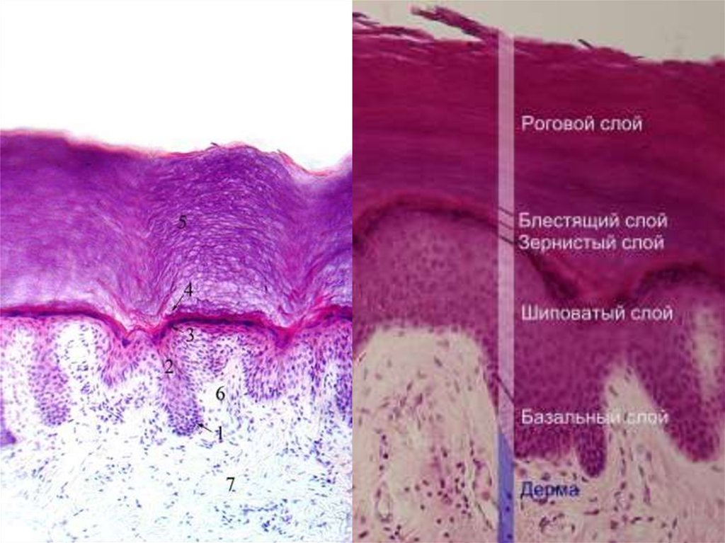 Кожа гистология. Строение эпидермиса гистология. Шиповатый слой кожи гистология. Эпидермис кожи гистологи. Слои эпидермиса гистология.