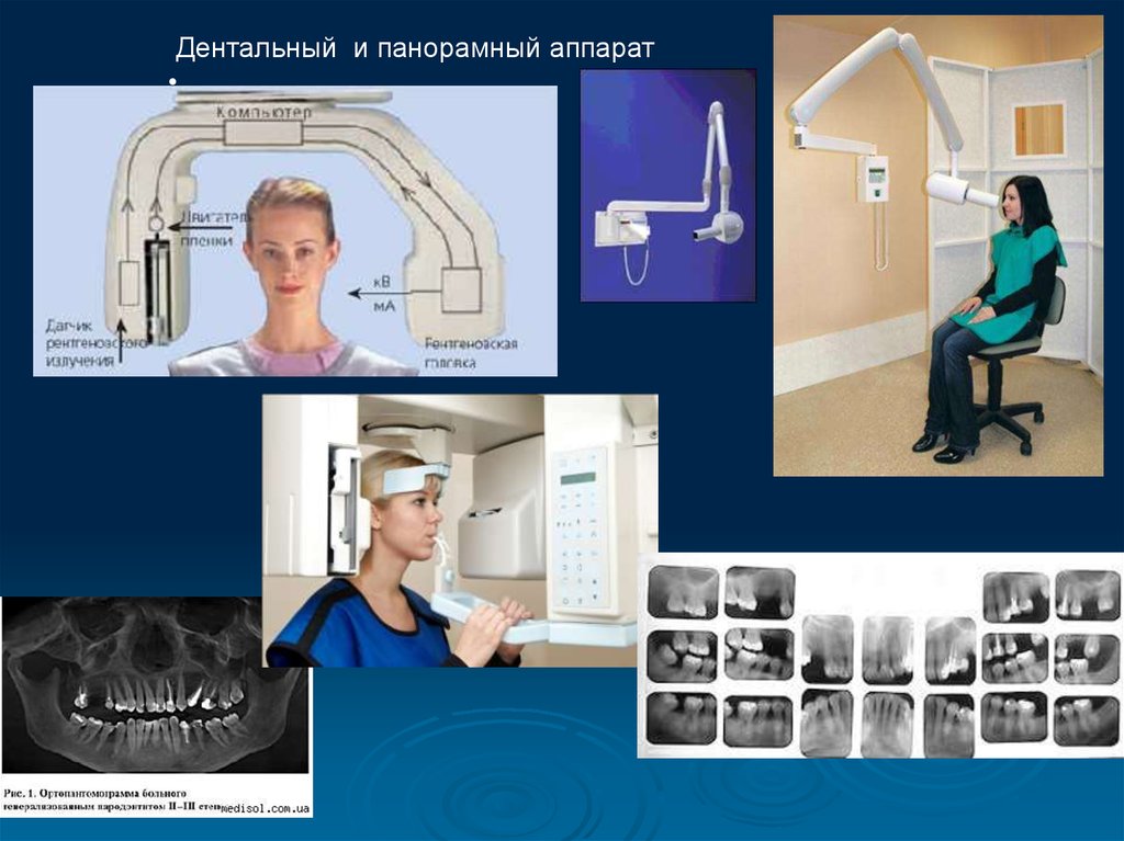 Методика получения рентгеновского изображения