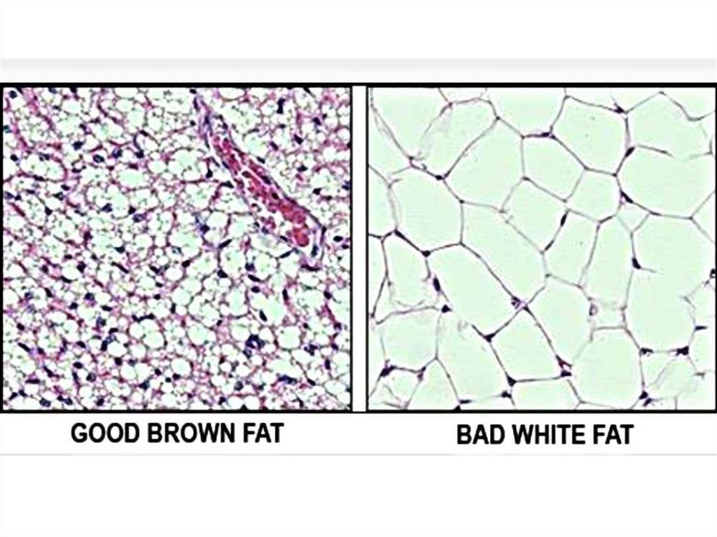 Жировая ткань рисунок