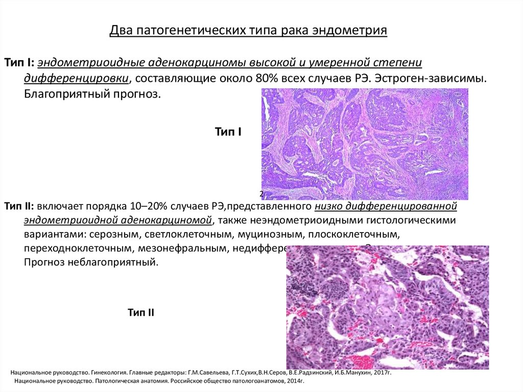 Гипопластического эндометрия