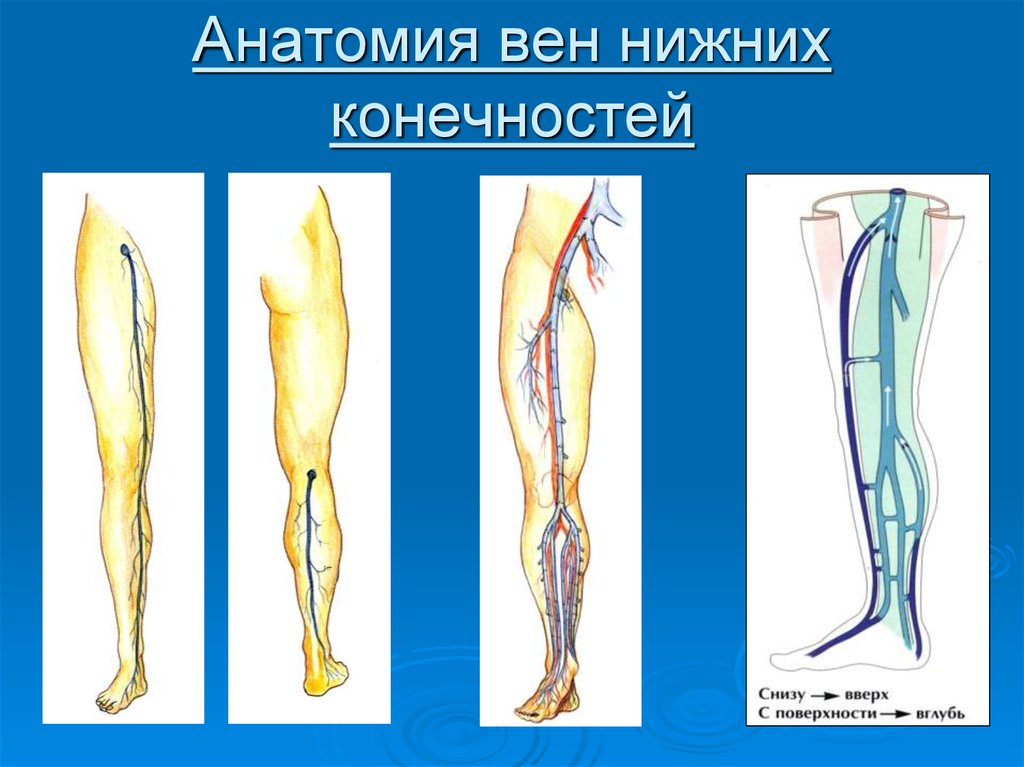 Заболевания вен нижних конечностей - online presentation