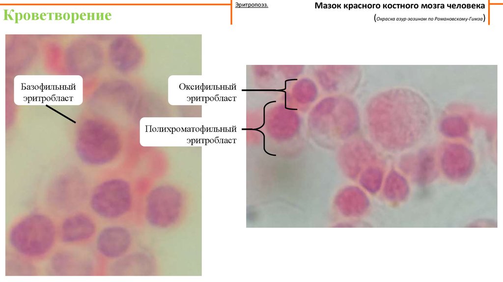 Красный мозг препарат. Мазок красного костного мозга окраска по Романовскому Гимза. Эритропоэз в Красном костном мозге. Срез красного костного мозга гистология. Мазок красного костного мозга препарат гистология.