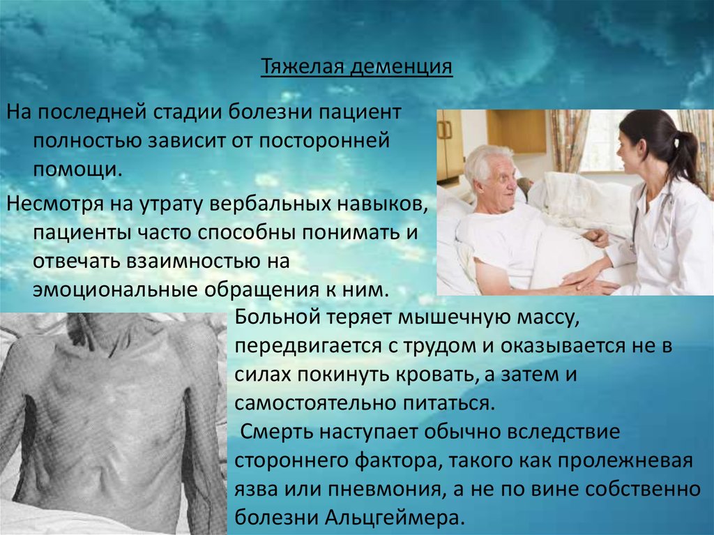 Болезнь альцгеймера врач. Клиническая картина деменции. Деменция последняя стадия. Деменция тяжелой степени.