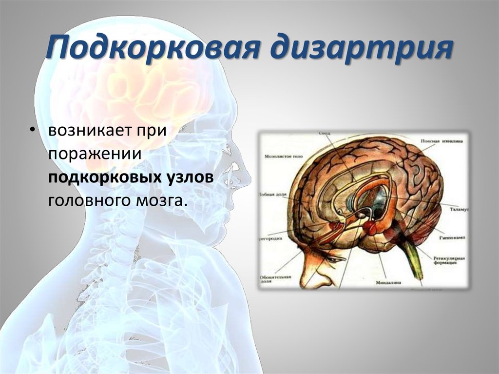 Мозжечковая дизартрия презентация