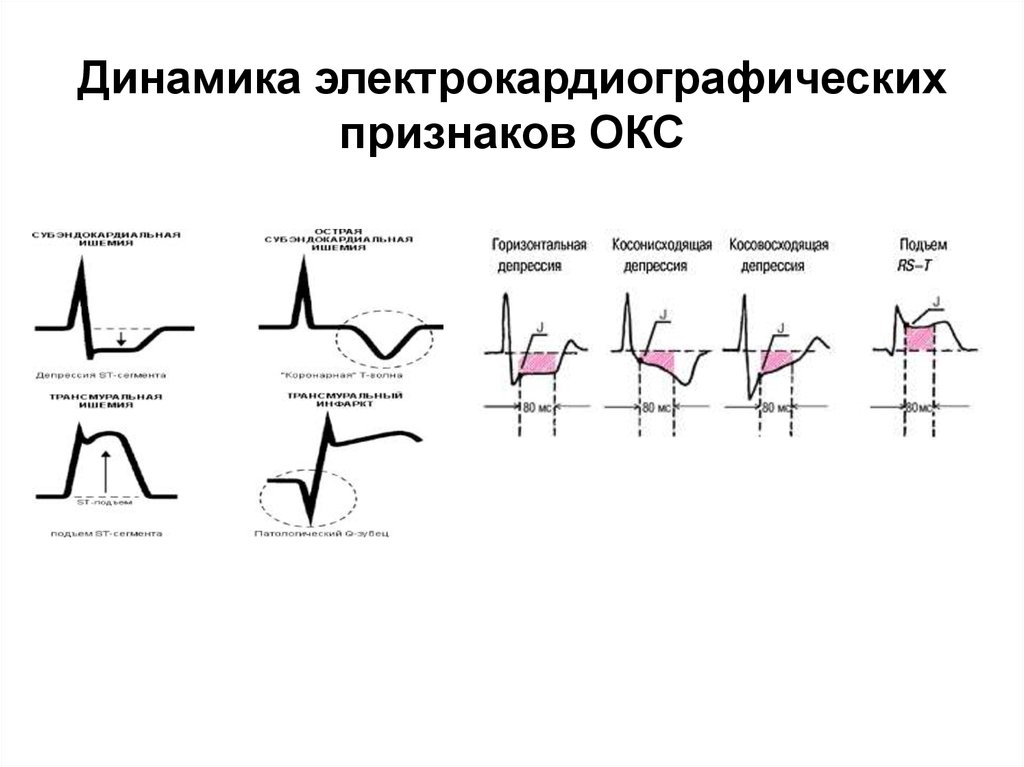 Критерии окс