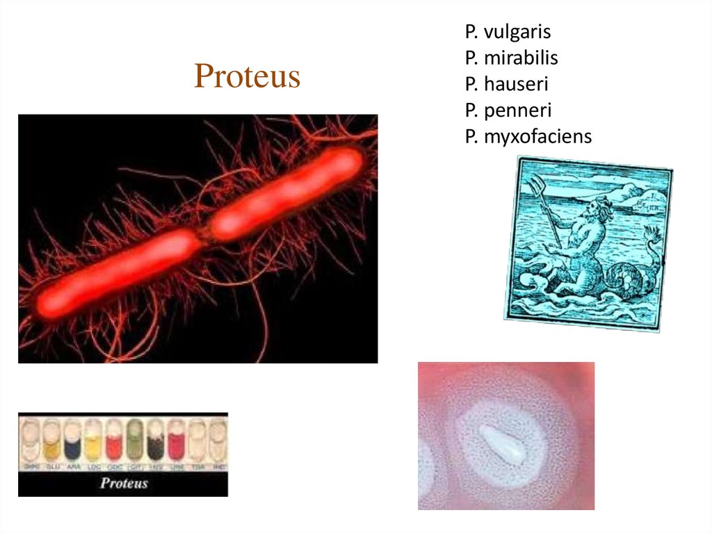 Proteus mirabilis что это такое