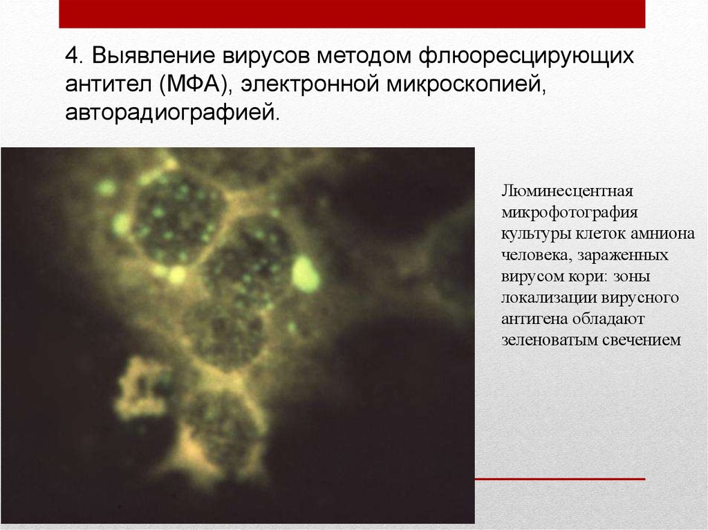 Называют обладают флюоресцируют. Метод люминесцентной микроскопии. Люминесцентная микроскопия вируса гриппа. МФА метод флюоресцирующих антител. Метод флюоресцирующих антител микробиология.