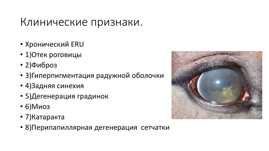 Клинические признаки.