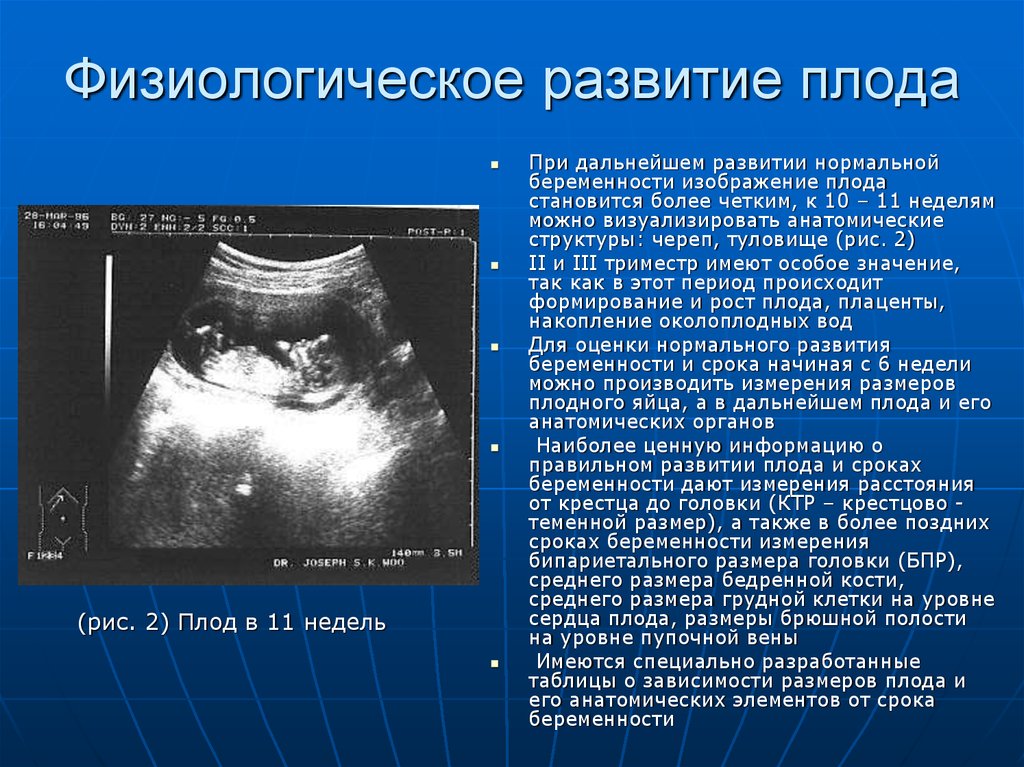 Развитие плода по неделям. Развитие беременности по УЗИ. Формирование плода по неделям на УЗИ. Размер эмбриона в 10 недель.