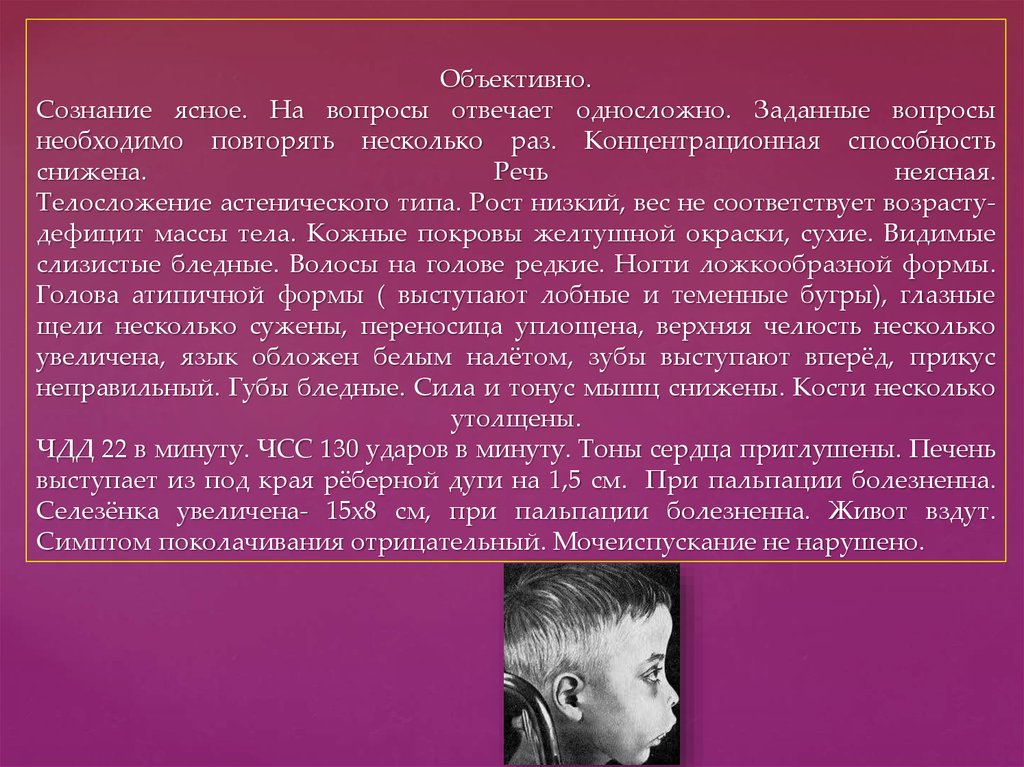 Цитата история болезни. Неясная речь. Сознание ясное на вопросы отвечает. В сознании, на вопросы отвечает односложно. Сознание ясно.