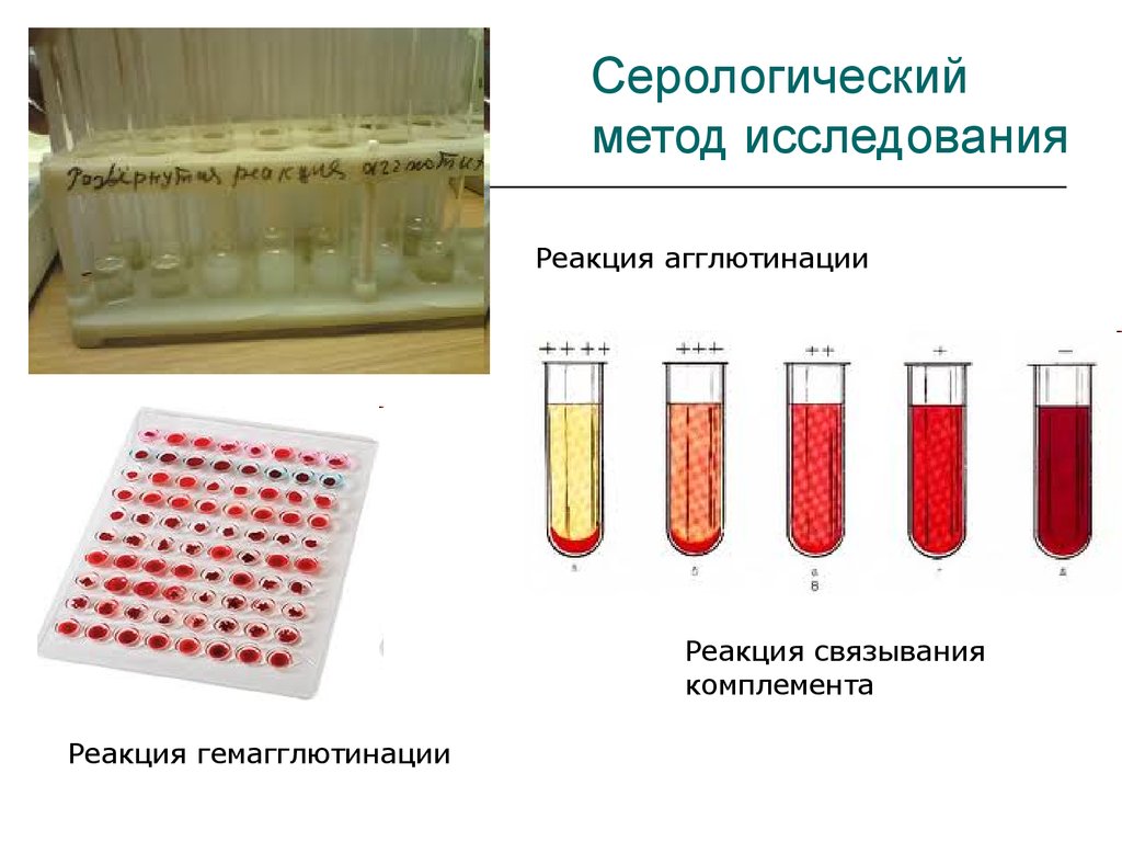 Сыворотка крови диагноз