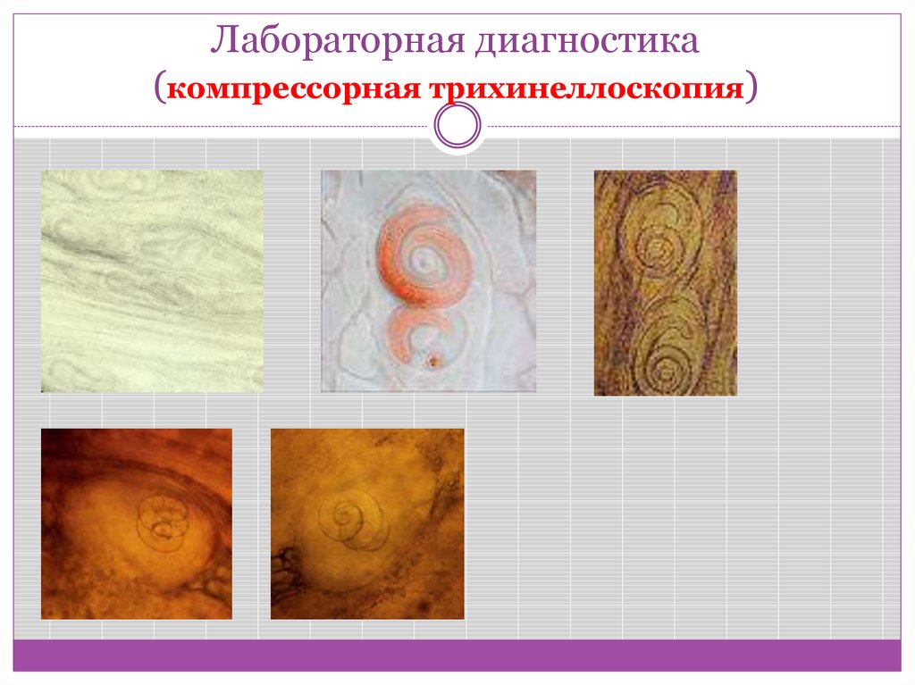 Трихинеллоскопию с обработкой срезов проводят для образцов