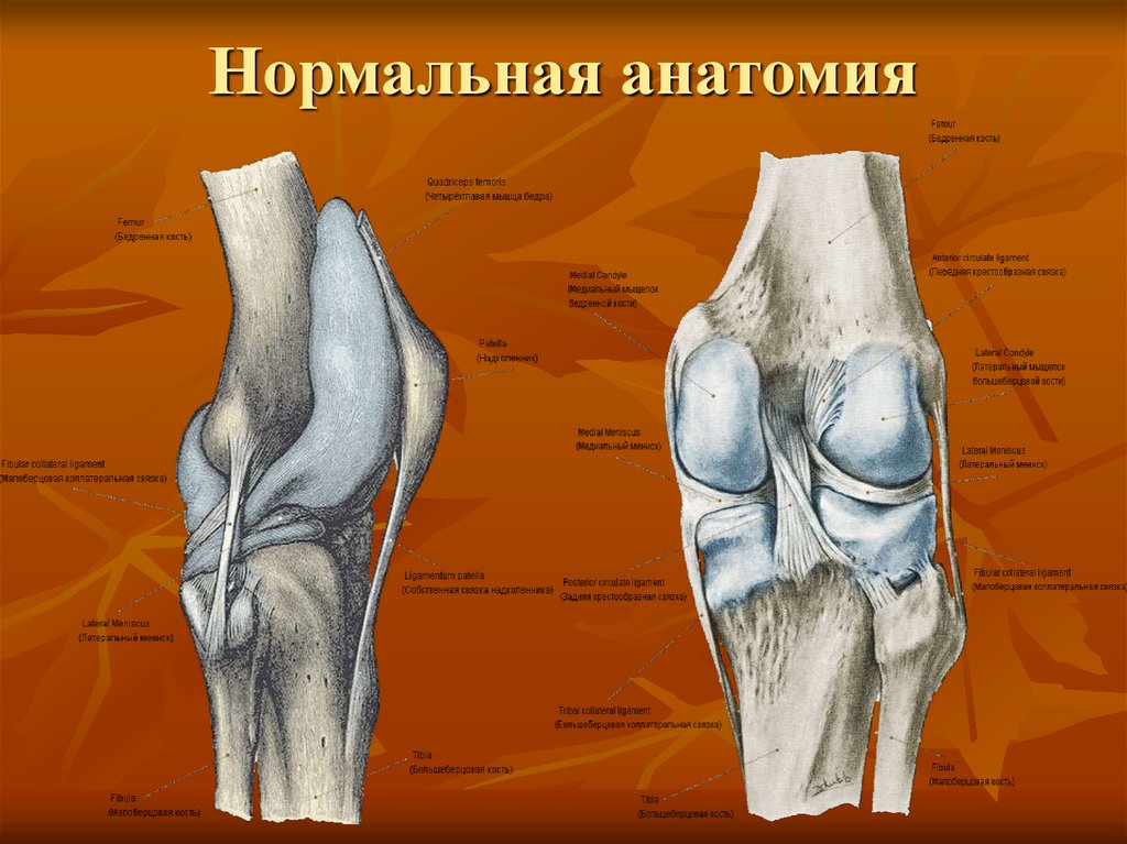 Повреждение коленного сустава презентация