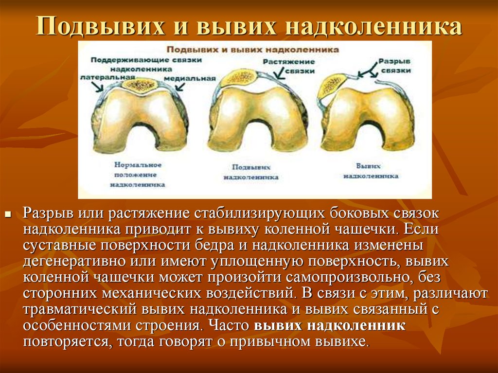 Перелом надколенника карта вызова скорой медицинской