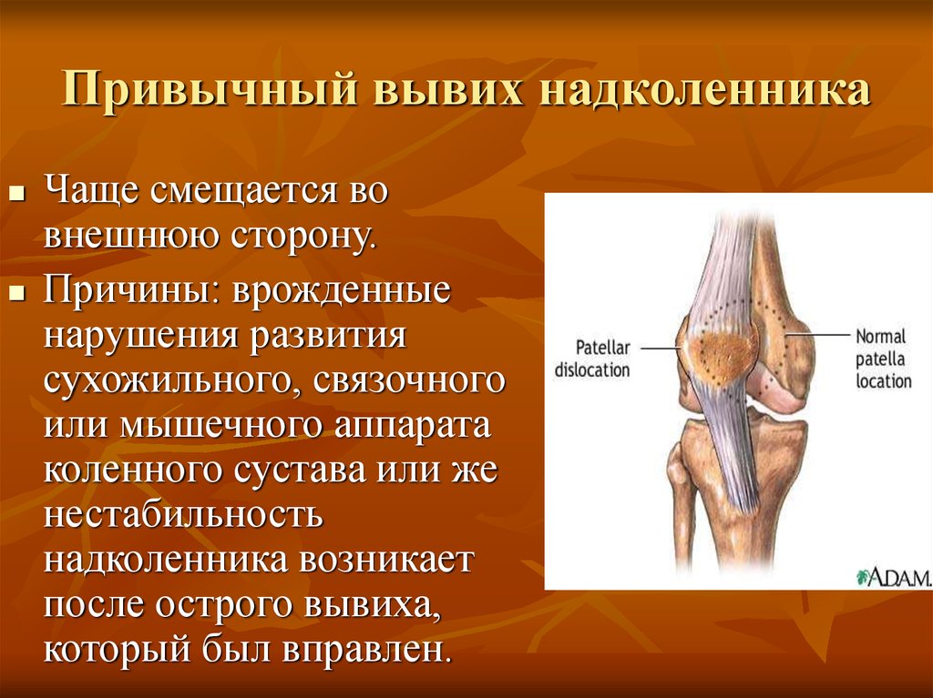 Вывих надколенника карта вызова