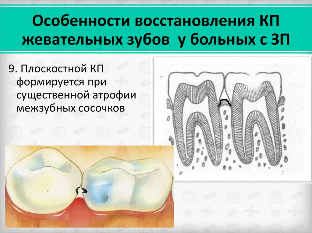 Пародонт тест