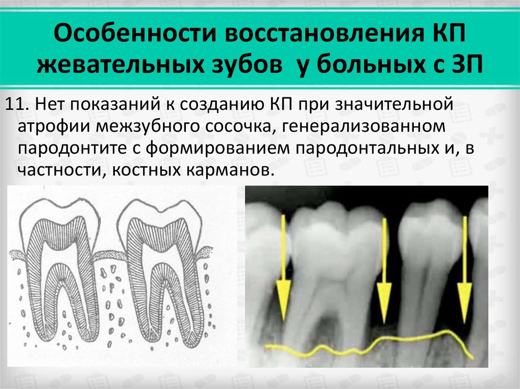 Фронтальная группа зубов рисунок