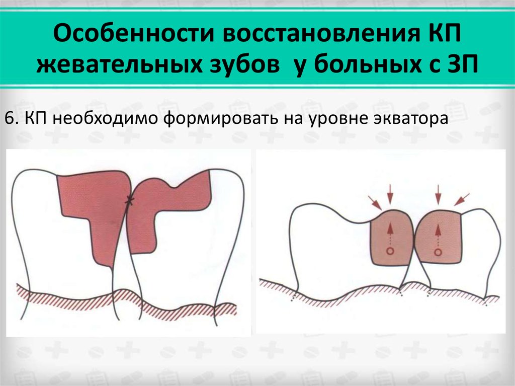 Фронтальная группа зубов рисунок