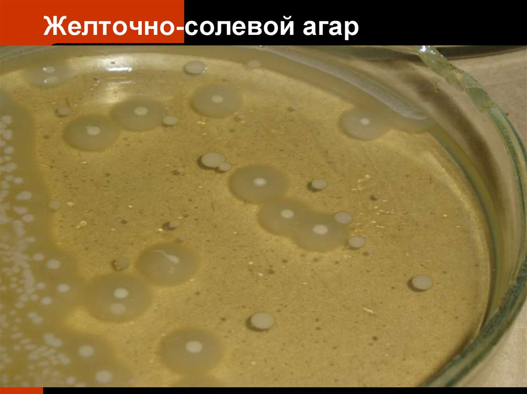 Staphylococcus aureus среда. Желточно-солевой агар (ЖСА). Стафилококк на желточно солевом агаре. Золотистый стафилококк на ЖСА. Рост стафилококков на ЖСА.