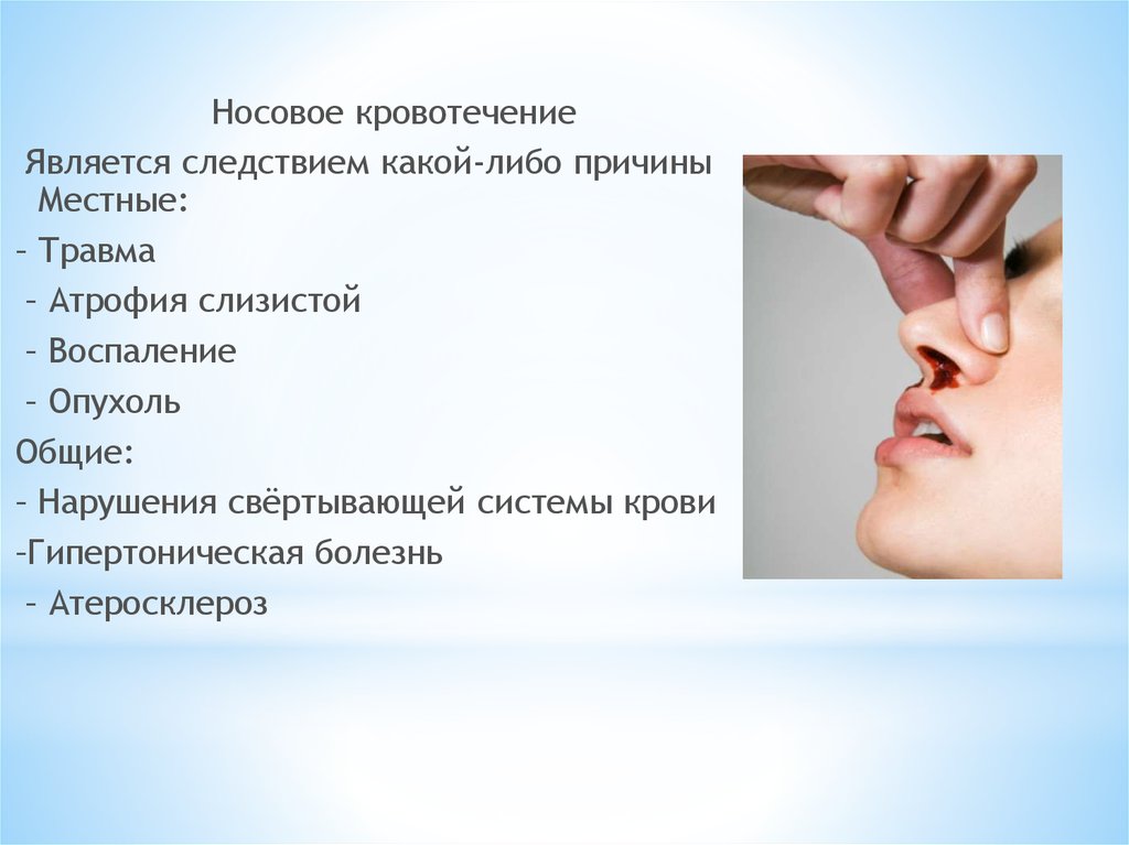 Причины носовых кровотечений разделяют на. Клинические признаки- кровотечение из носа. Симптомы носового кровотечения. Клинические признаки носового кровотечения. Симптомы нового кровотечения.