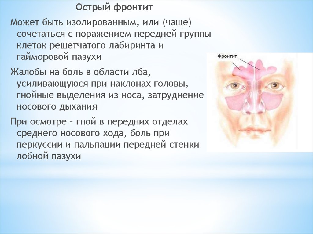 Фронтит болит голова. Острый фронтит симптомы. Острое воспаление решетчатого Лабиринта. Клетки решетчатого Лабиринта.