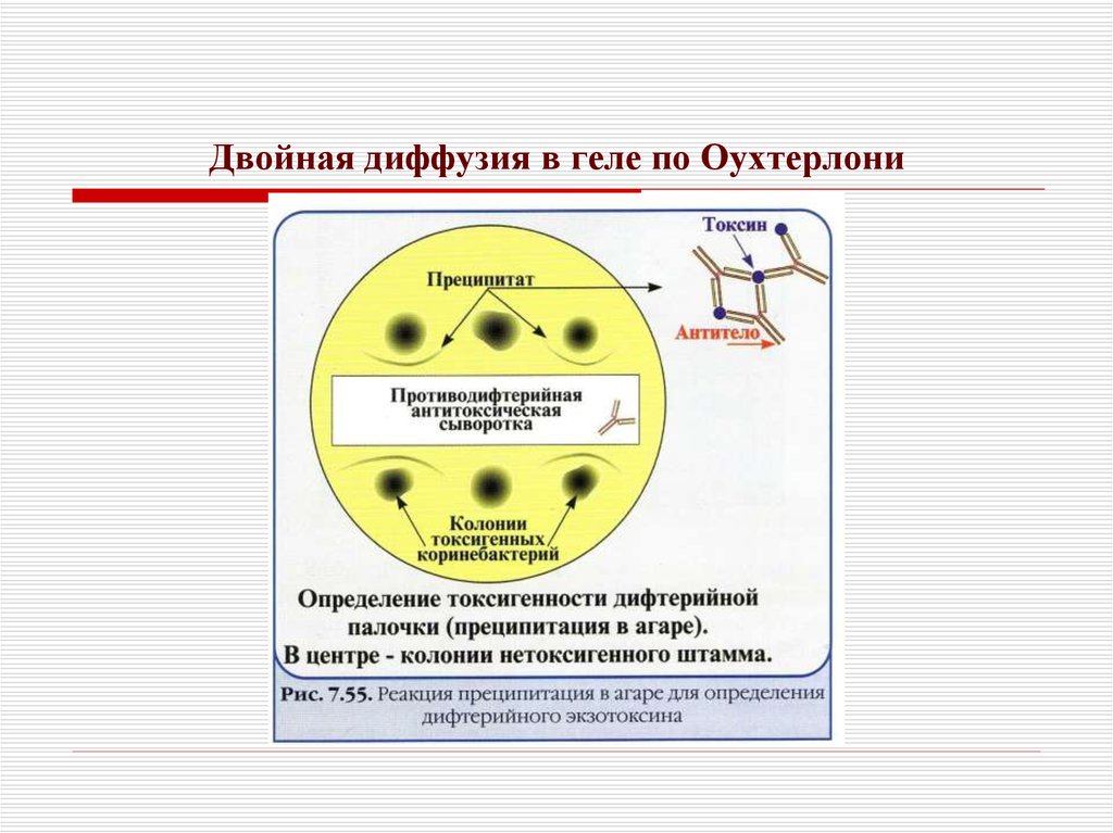 Реакция двойной иммунодиффузии по оухтерлони картинки