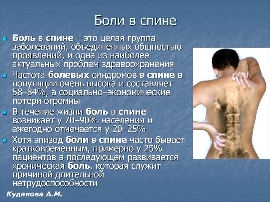 Синдром боли в спине. Боль в спине презентация. Боли в спине ppt. Характеристика боли в спине.